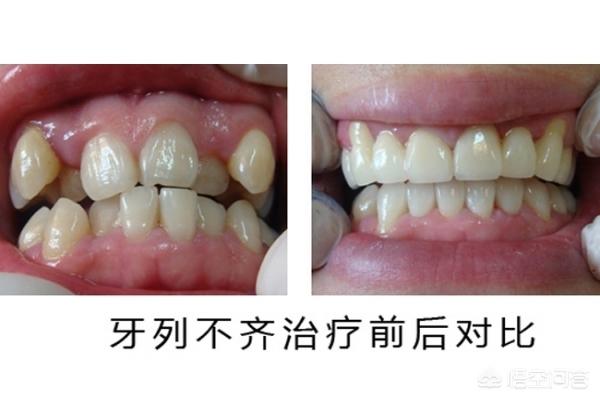 北京最新24小时牙医在线咨询方法分析(最方便真实的北京有没有24小时牙医方法)
