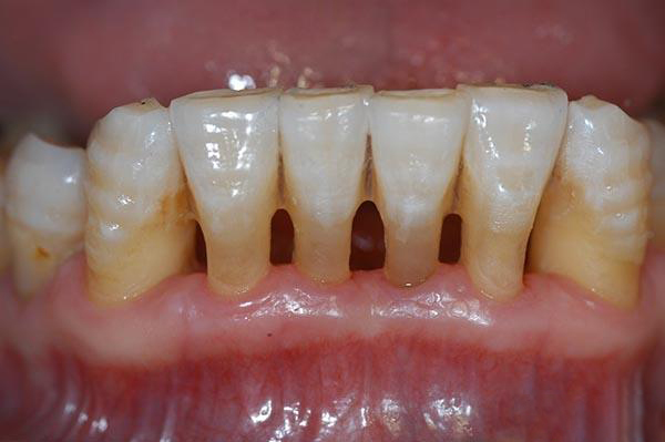 北京最新24小时牙医在线咨询方法分析(最方便真实的北京有没有24小时牙医方法)